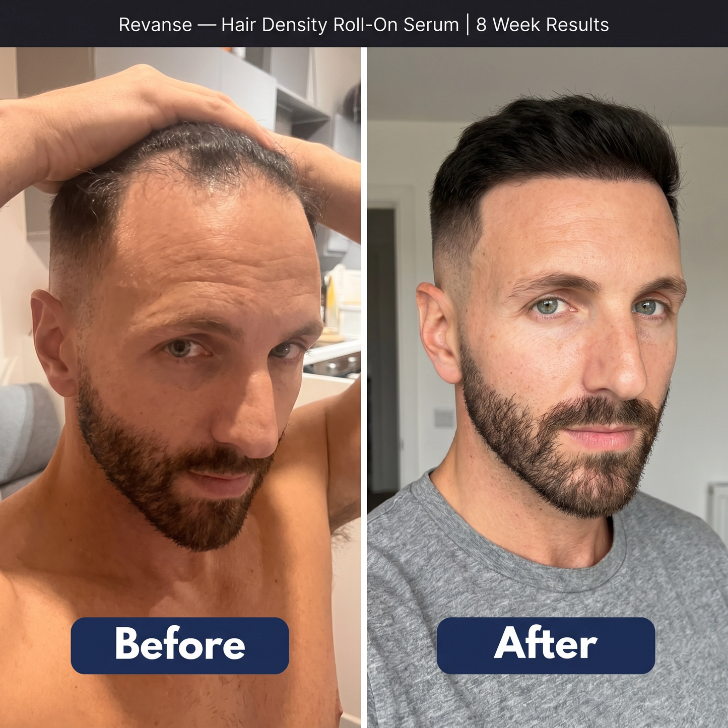 Revanse - Health Growth Serum