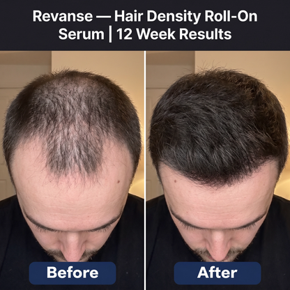 Revanse - Health Growth Serum